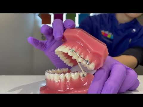 Carriere® Motion In Action