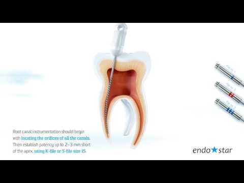 download lagu mp3 mp4 Endostar, download lagu Endostar gratis, unduh video klip Endostar