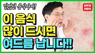 여드름 없애는 방법? 치킨부터 줄여보세요! #여드름관리 #피부좋아지는법 #여드름없애는방법
