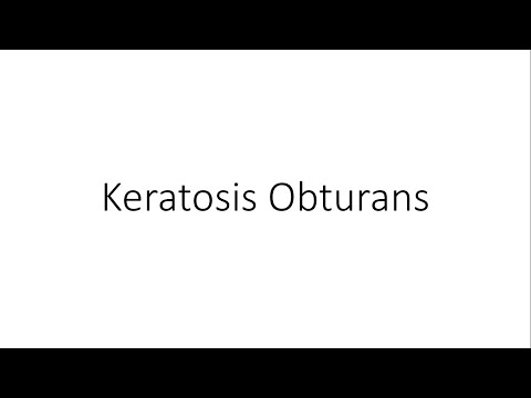 Keratosis Obturans - ENT