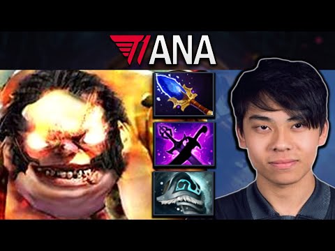 Pudge Dota 2 Gameplay T1.Ana with 22 Kills and Kaya - Sange