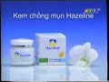Hazeline Anti Acne Cream Vietnam 2001