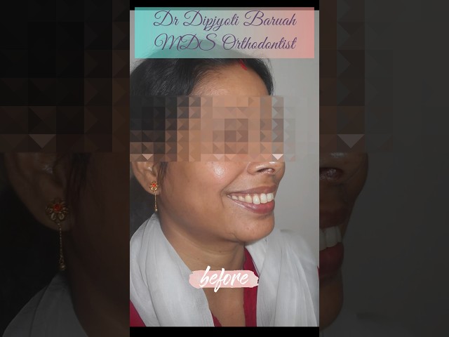 Thumbnail for Post ID: RjMiPZJ5lfE