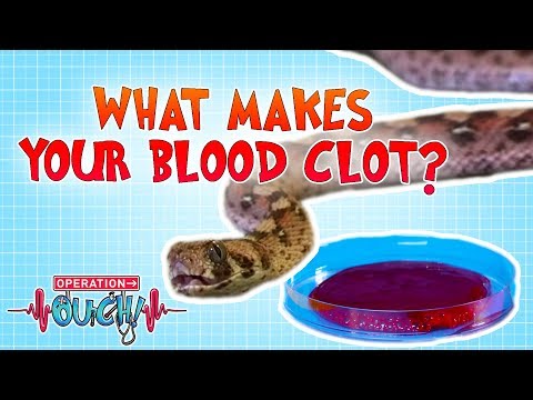 What Makes Your Blood Clot? | Operation Ouch | Science for Kids