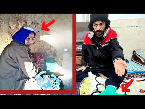 Schrecklicher Unfall im Sturm – Ein Mann kehrte mit einem gebrochenen Bein zurück 😱😱💔