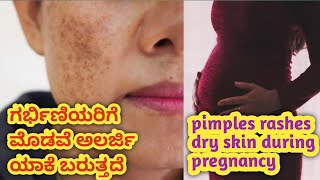 ಗರ್ಭಿಣಿಯರಿಗೆ ಮೊಡವೆ ಅಲರ್ಜಿ ಯಾಕೆ ಬರುತ್ತದೆ l how to reduce pimples during pregnancy l