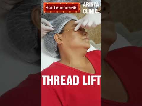 ร้อยไหม คอ ล ลา เจน