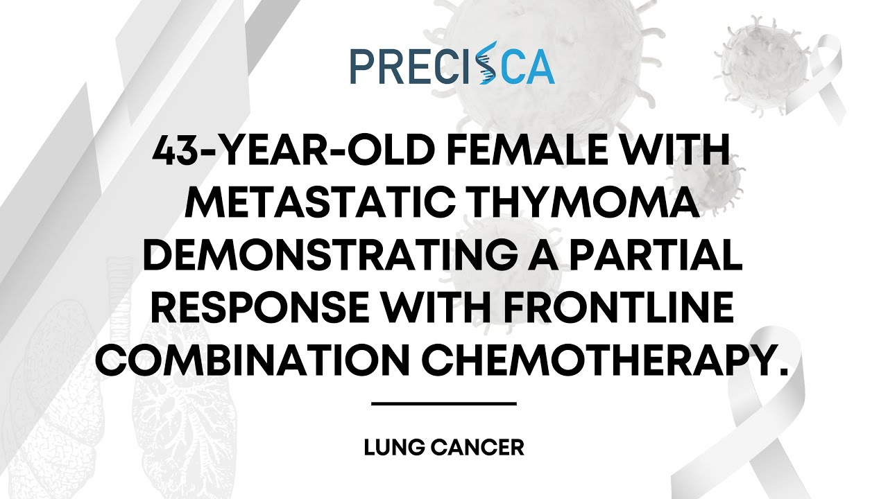 Expert Cancer Panel: Metastatic thymoma w/ partial response from front-line combination chemotherapy