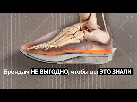 КАРБОН, ПРОНАЦИЯ, СУПИНАЦИЯ — большая ЛОЖЬ бегового маркетинга