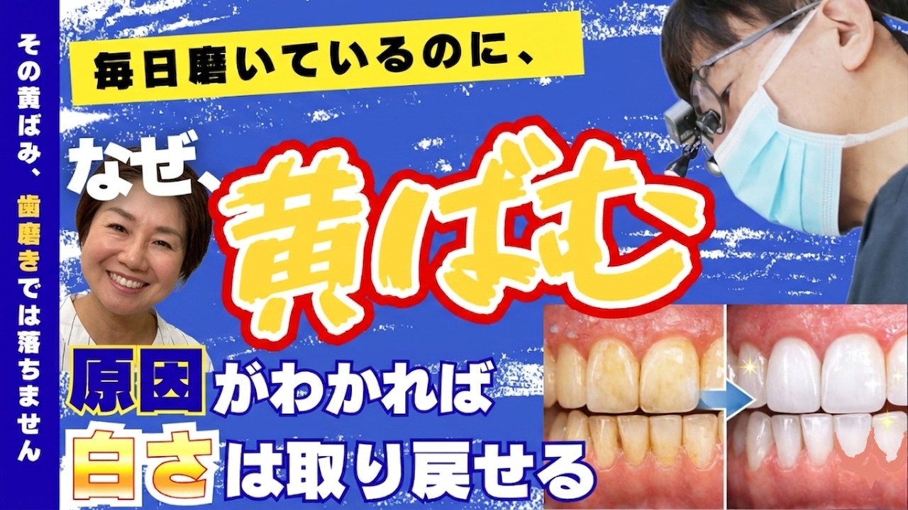 歯の黄ばみでお悩みの方　原因別の治療法を岡山の歯科医師が解説します