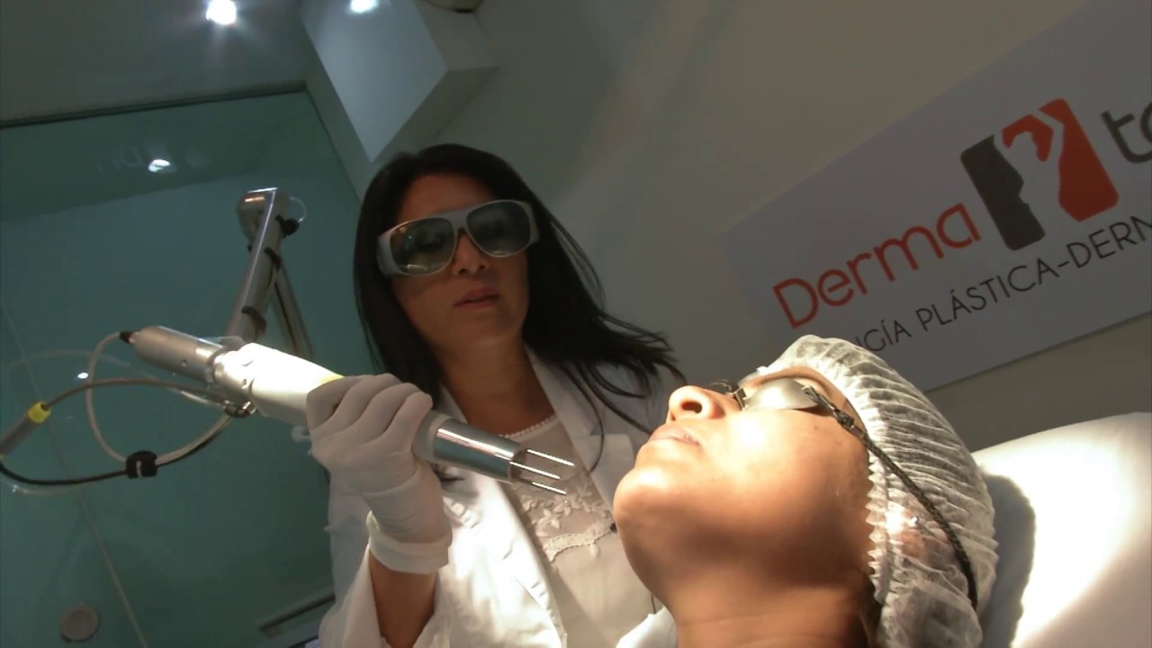 TRATAMIENTO LÁSER Q- SWITCHED