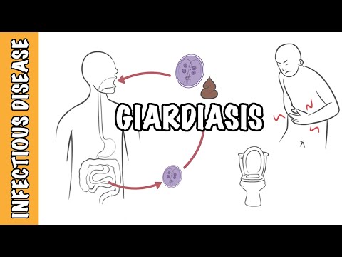 Lamblioza (giardioza) - infekcja Giardia Lamblia (Giardia intestinalis, Giardia duodenalis)