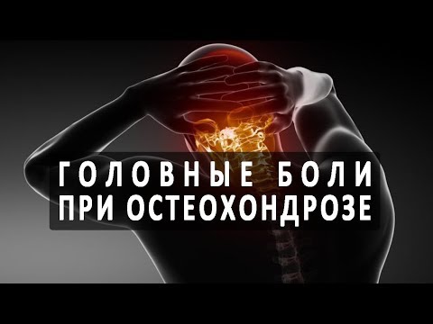 Упражнения после остеохондроза поясничного отдела Лучезапястный сустав замена в россии
