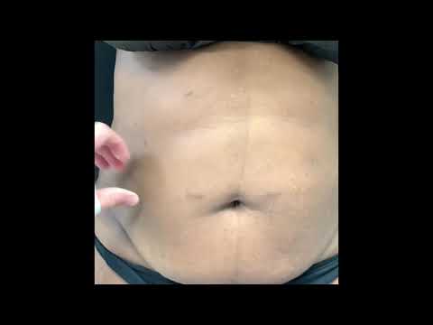 Video thumb
