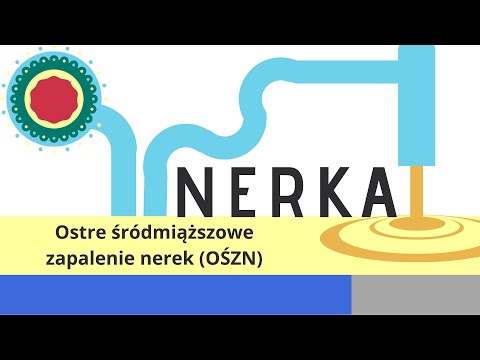 Nerka: Ostre Śródmiąższowe Zapalenie Nerek