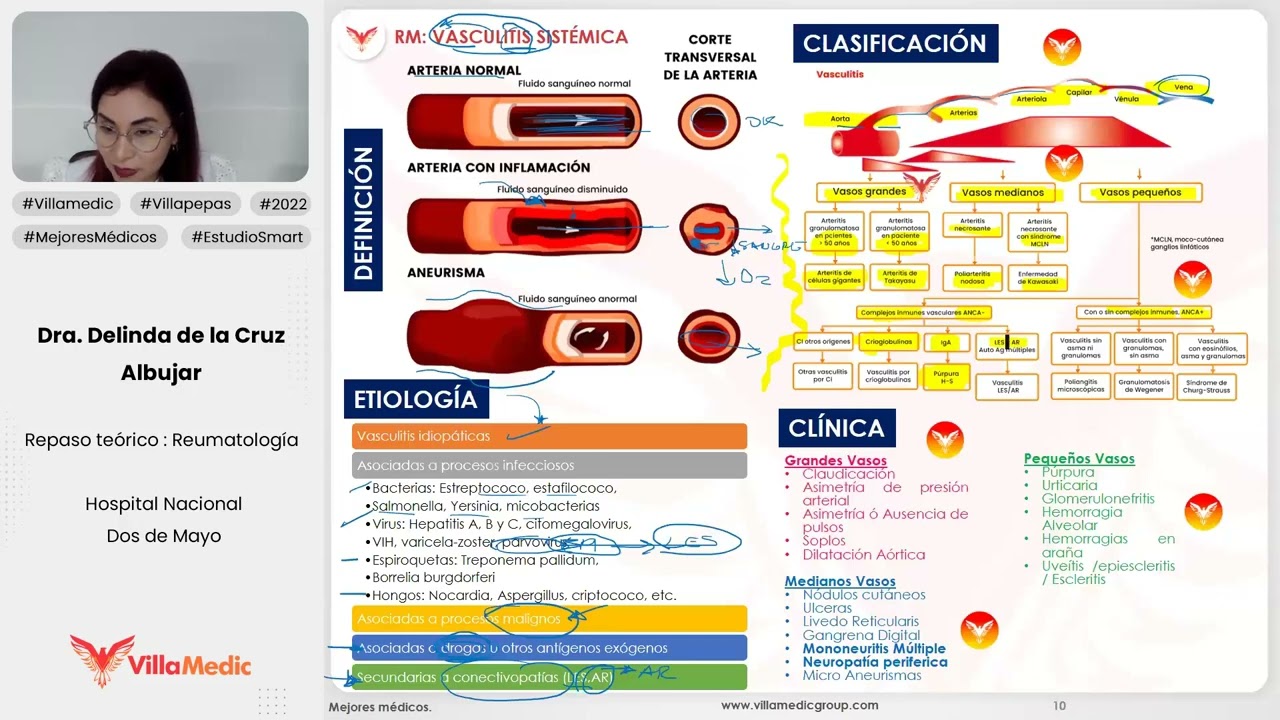 VASCULITIS SISTÉMICA - REUMATOLOGÍA - VILLAMEDIC