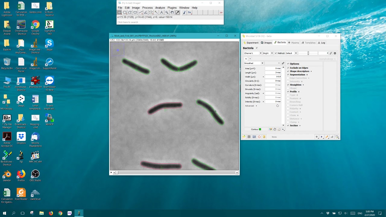 Cell detection using microbeJ.