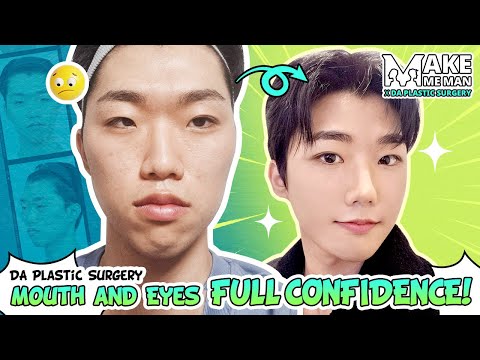 [Plastic Surgery Korea] My Nerdy Man's Huge Transformation🧒