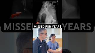 Powerlifter With Chronic Pain (Real Cause Found) @DrRahim