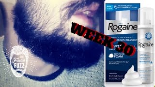 Minoxidil Beard | Week 30 | The Experiment | #Facialfuzzfridays