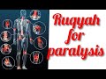 Ruqyah For Paralysis