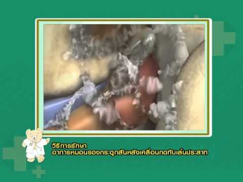 วิธีการที่จะเพิ่มขึ้นในสมาชิกในความกว้าง 2012 โฆษณาแรง