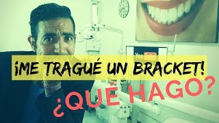 Se me cayó / Me tragué un bracket. ¿ y ahora qué hago
