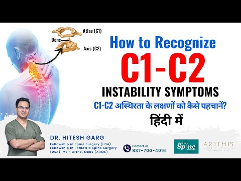 How to recognize C1-C2 instability symptoms? Ask Best Spine Surgeon in India | Spine Doc in Gurgaon