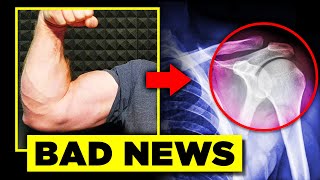 One Of The Worst Armwrestling Injuries Possible