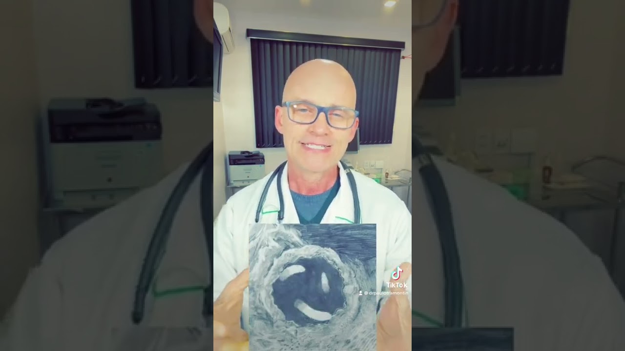 Como os vermes vão parar em nossa cabeça? Sintomas da Neurocisticercose.