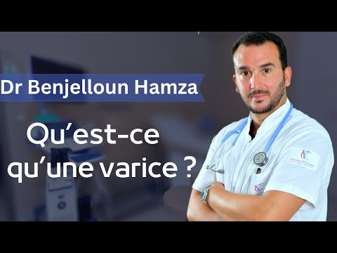 Qu’est-ce qu’une varice ?