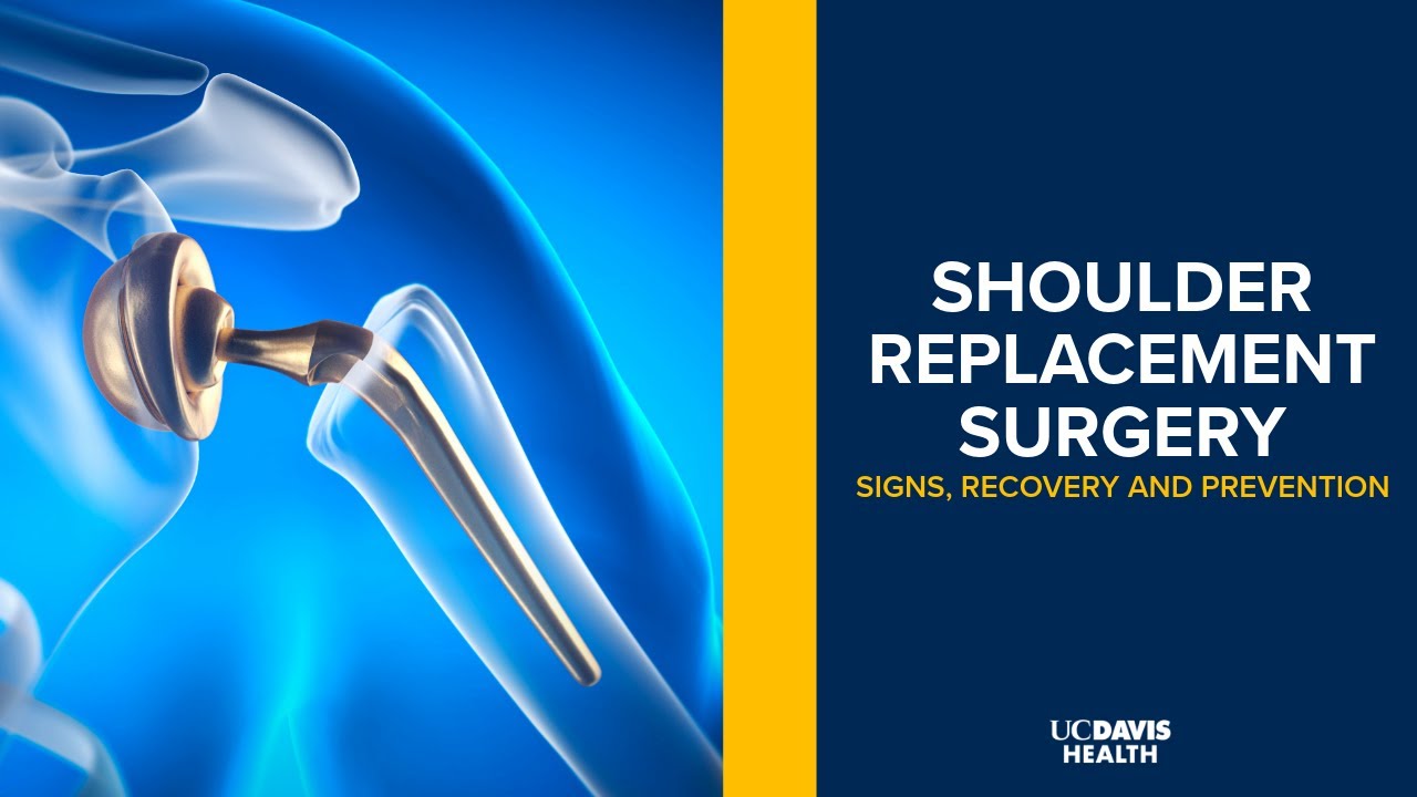 Thumbnail preview of Shoulder Replacement Surgery Explained