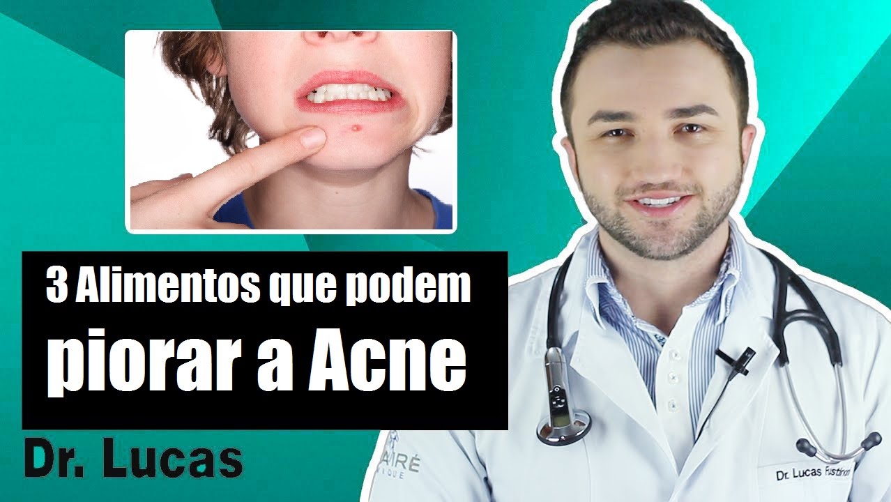 3 Alimentos que podem piorar a Acne - Dr Lucas Fustinoni