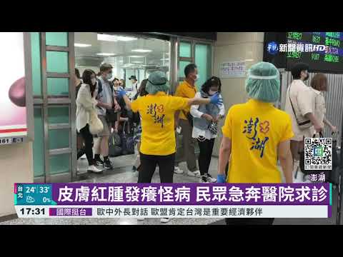 澎湖"紅疹怪病" 醫:不排除毛毛蟲皮膚炎