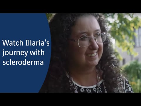 What happens when you have systemic sclerosis?