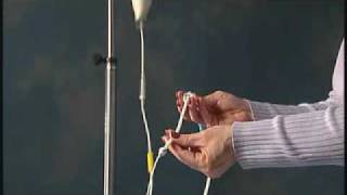Product video: 14 Fr AMT Mini ONE Balloon Button Low Profile G-Tube