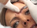 Brzowski Plastic Surgery