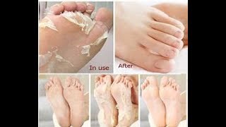REMOVE DEAD SKIN FROM FOOT | FOOT MASK PEELING CUTICLES | FEET CARE ANTI AGING | ZILOQA