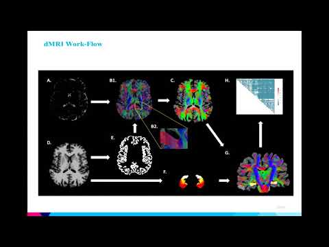 8th Annual TMII Symposium – 2018 – Session I – Neuroimaging – Jack Rutland, BA