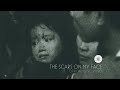 XOI The Scars On My Face Official Music Video