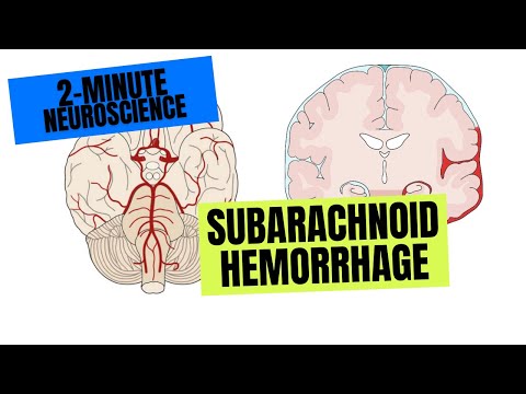 2-Minute Neuroscience: Subarachnoid Hemorrhage