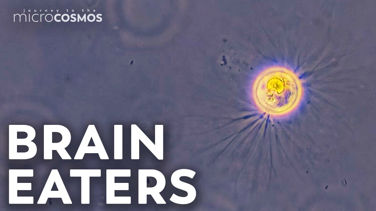 Avoid These Tiny Bits of Killer Fluff (If You Can)