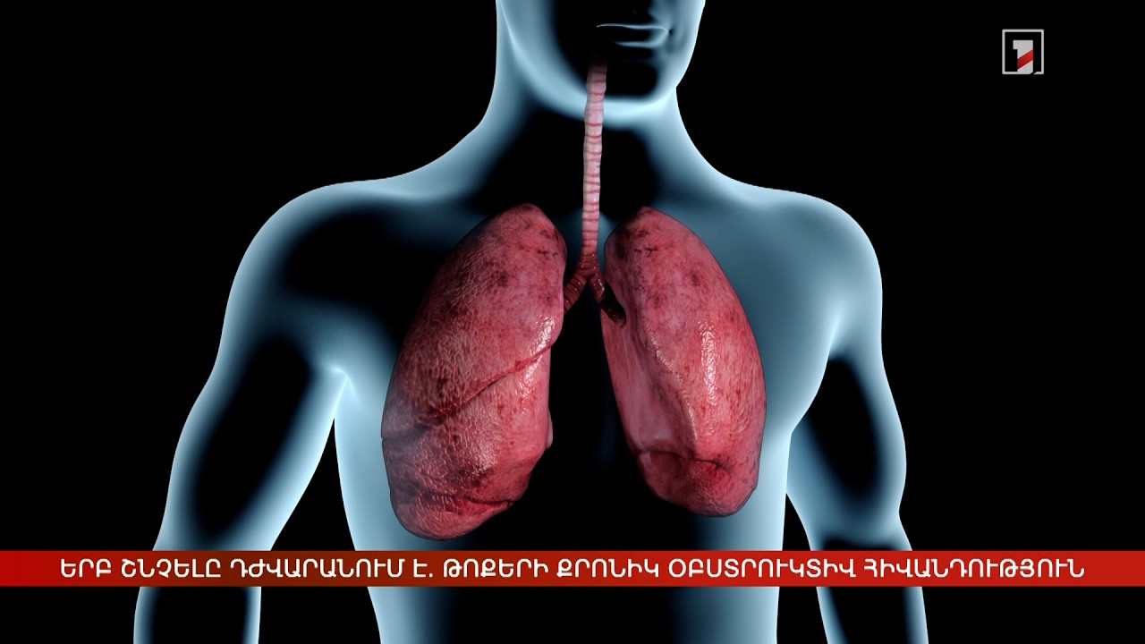 Երբ շնչելը դժվարանում է. թոքերի քրոնիկ օբստրուկտիվ հիվանդություն