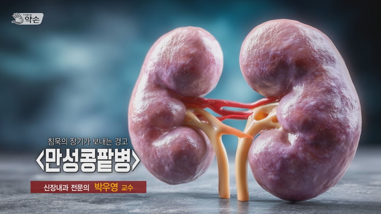 침묵의 장기가 보내는 경고! '만성콩팥병' ㅣ 신장내과 박우영 교수 관련사진