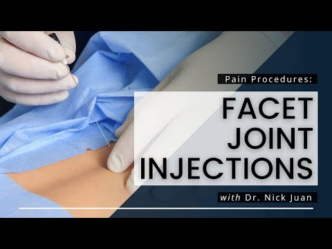 Facet Joint Injections: What You Need To Know