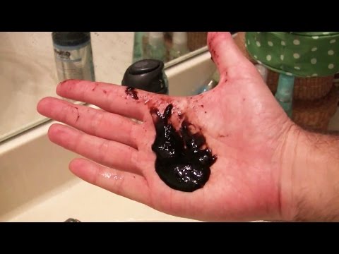 Neti Pot чайник для промывания носа солью кукушка ирригатор нети пот от гайморита аспиратор для детей взрослых - фото 1 - id-p1069040312