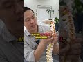 The Truth About A Chiropractic Y Strap