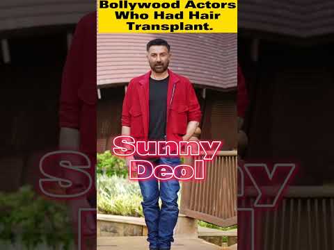 Famous Bollywood Actors who had hair Transplant. #shorts
