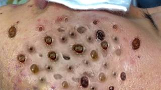 𝐑𝐞𝐟𝐫𝐞𝐬𝐡 𝐘𝐨𝐮𝐫 𝐅𝐚𝐜𝐞 𝐖𝐢𝐭𝐡 LNG 𝐒𝐤𝐢𝐧 𝐂𝐚𝐫𝐞 #