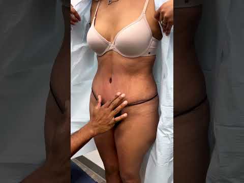 Doctor explaining the result #plasticsurgeons #doctor #cosmeticsurgery